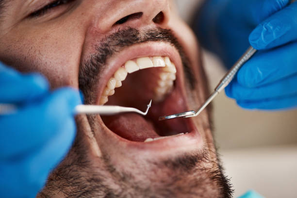 Best Mobile Emergency Dentist in El Granada, CA