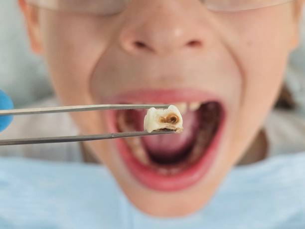 Best Holiday Emergency Dentist in El Granada, CA